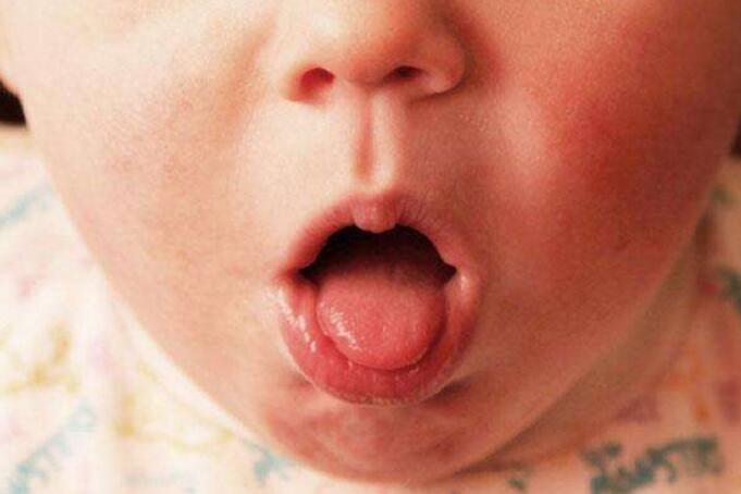 小儿过敏性哮喘的推拿方法