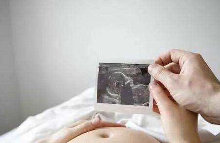 怀孕后做什么影响胎儿