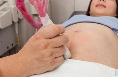 羊水穿刺适合哪些孕妇？