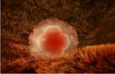 孕早期出血不要慌