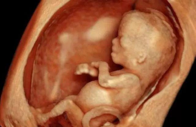 怎么知道胎位是否正 纠正胎位做这3个动作就行