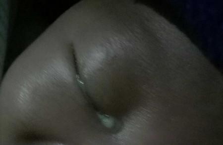 宝宝眼屎多是什么原因引起的