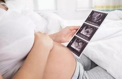 孕周不同胎儿活动差别大吗