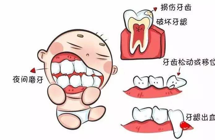 宝宝长期磨牙是怎么回事