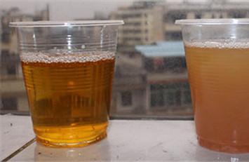 前列腺炎会出现脓尿吗 脓尿是怎么引起的？