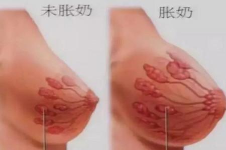 生理性涨奶怎么办 教你一招非常有效