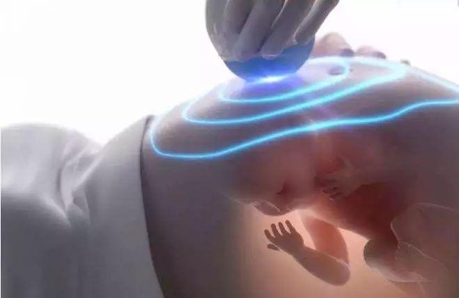 怀孕33周是什么情况