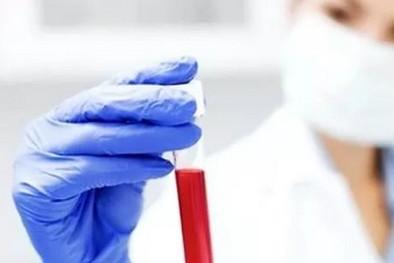 糖筛检查前不能做什么