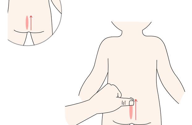 小儿推拿七节骨的作用