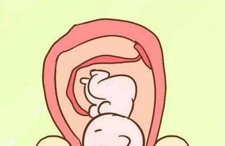 胎儿入盆的感觉和症状