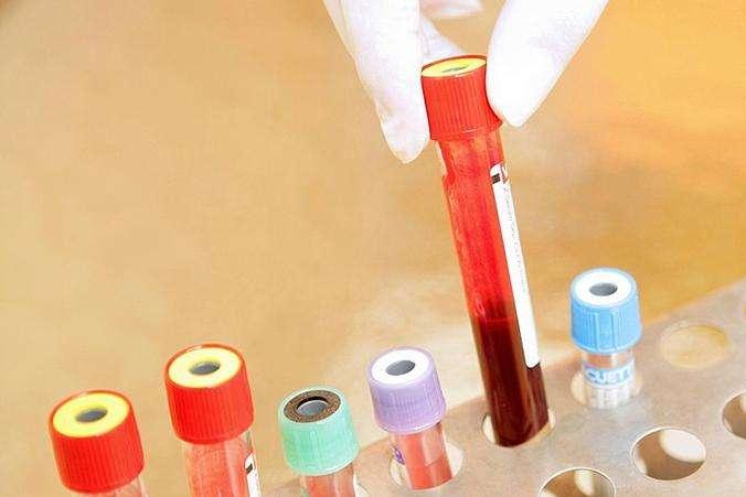 宝宝多大检查乙肝抗体