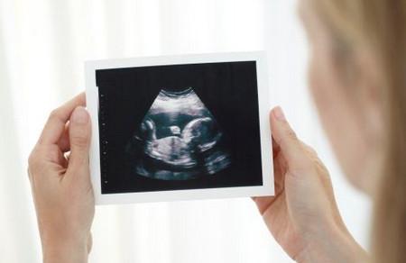 为什么大排畸放在孕中期？