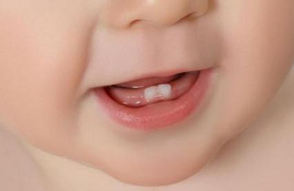 关于宝宝牙齿的问题有哪些