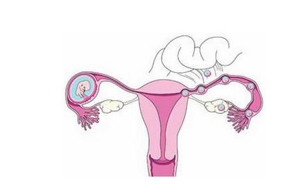 黄体功能是什么  黄体功能不全有什么影响