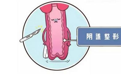 阴道松弛怎么改善 简单几招变紧致
