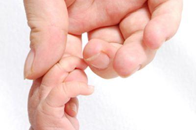 新生儿黄疸消退顺序