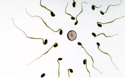 男性少精癥的原因是什么