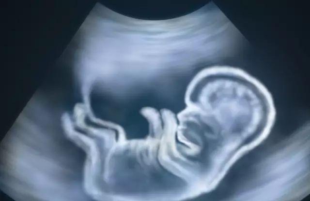 胎儿有缺陷能检查出来吗