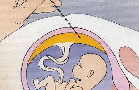 孕妇喝水能补充羊水吗