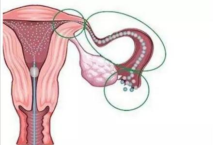 输卵管堵塞是什么造成的 输卵管怎样检查通不通