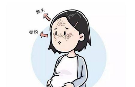 孕期怎么样能预防色斑