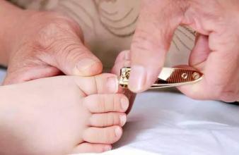 宝宝剪指甲剪到肉怎么办