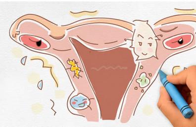 影响女性怀孕的妇科疾病有哪些