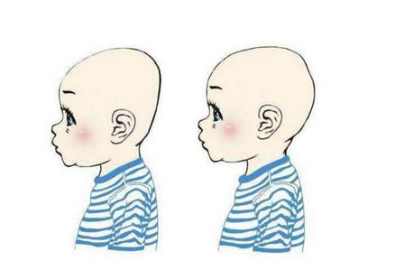宝宝睡什么头型最聪明