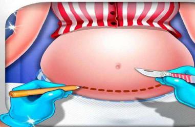 剖腹产麻醉会留下后遗症