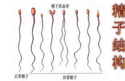 男性如何自测精子质量