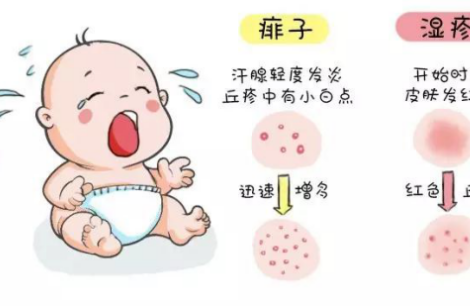宝宝湿疹和热疹的区别，这几张图片一对比就知道了