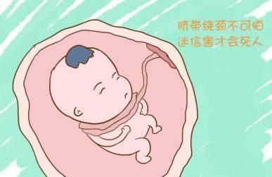 孕期怎么知道脐带绕颈