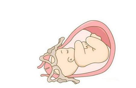 胎儿入盆后孕妈需要注意什么