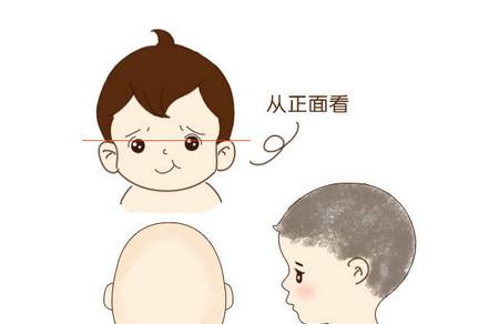  小儿积食会反复发烧吗