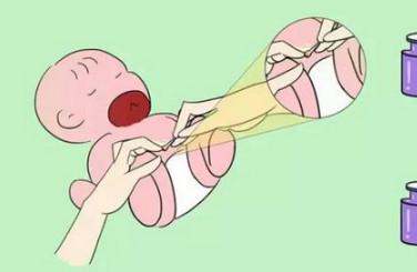 新生儿脐带护理要点