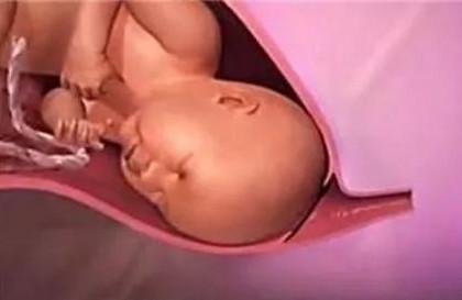 胎儿是如何从产道分娩出的?