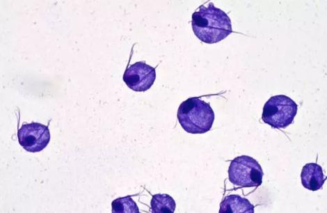 备孕期间得阴道炎怎么办