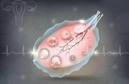 生长激素能改善试管婴儿成功率吗