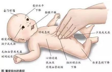 宝宝腹泻有可能感染了轮状病毒