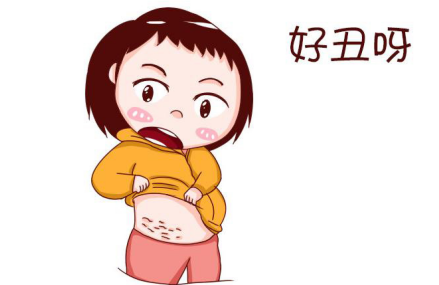 肚皮上的妊娠纹怎么消 潮妈祛妊娠纹经历在这儿