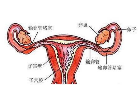 输卵管和不孕症有多大关系？