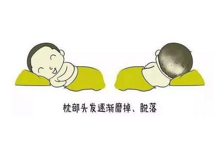 缓解宝宝枕秃的方法有哪些
