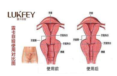 缩阴产品对身体有伤害吗？后悔没用这款产品！