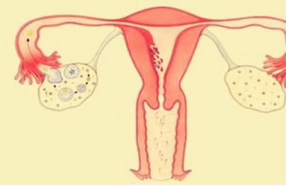 输卵管堵塞为什么做了通水后还不孕？