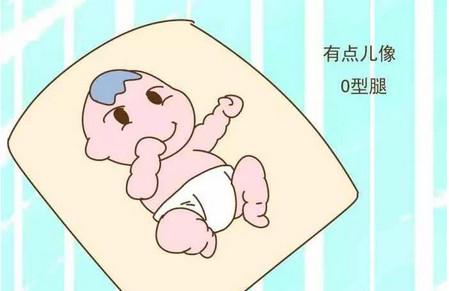 孩子O型腿、X型腿是什么原因造成的