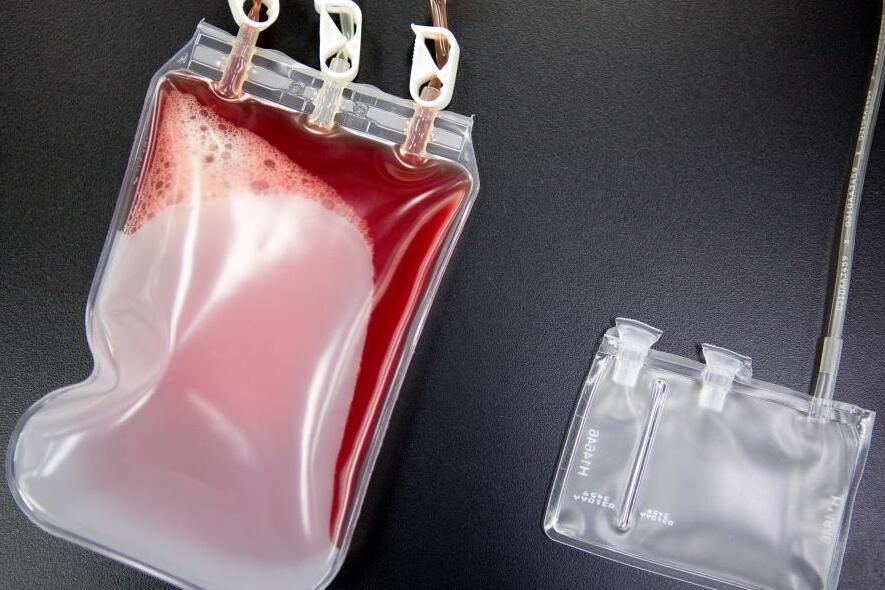 新生儿脐带血怎么保存