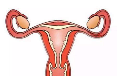 输卵管性不孕如何治疗