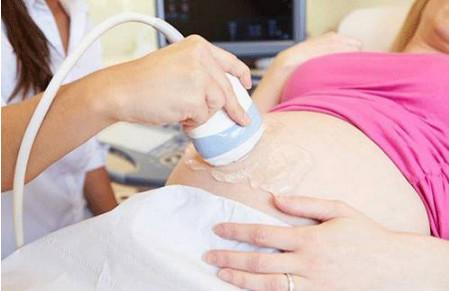 孕期超声检查需要知道什么？