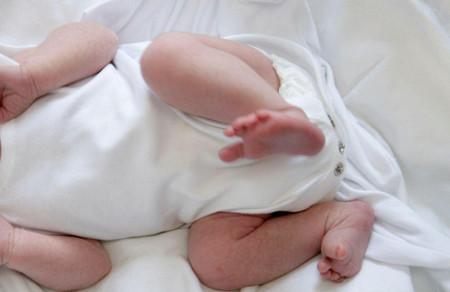 宝宝出现母乳性黄疸如何护理