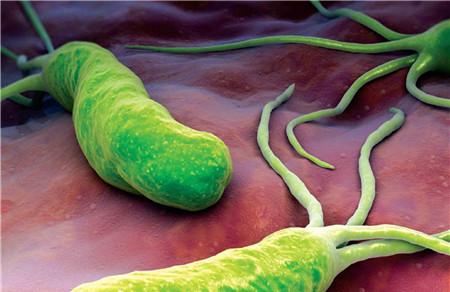 幽门螺旋杆菌会引起便秘吗 便秘跟幽门螺旋杆菌有关系吗？